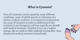 is cyanosis an emergency first aid