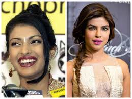 bollywood actresses from ugly to beautiful