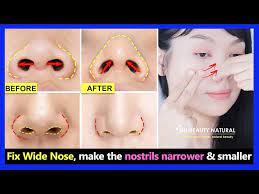 fix wide nose without surgery make the