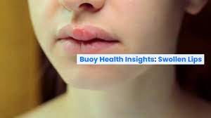 swollen lips common causes and when to