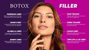 botox and filler what fits for you