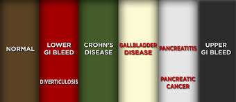 Poop Color Chart The Dr Oz Show