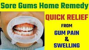 sore gums home remedy quick relief