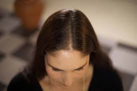 what causes hair loss magic hair