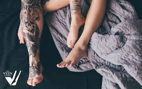 can you tattoo on varicose veins