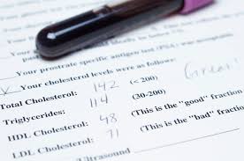 What Is Total Cholesterol And What Does It Mean