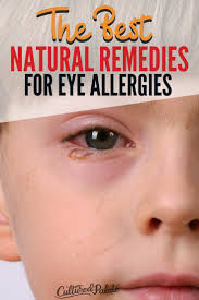 natural remes for eye allergies