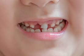 teeth injury in children how to treat