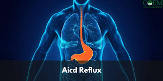 Acid Reflux: Causes, Symptoms and Treatment