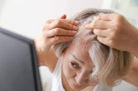 scabs on scalp causes and treatments