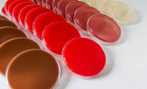 preparation of selective agar plates