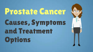 This is because in the early stages, prostate cancer often doesn't have many symptoms. Prostate Cancer Causes Symptoms And Treatment Options Youtube