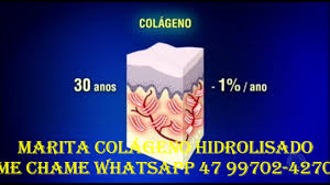 We did not find results for: Marita Colageno Hidrolisado Qual O Melhor Colageno Youtube