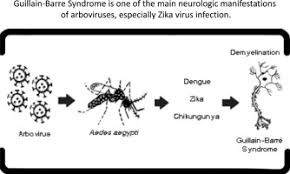 It can lead to weakness and paralysis that may last for months or years. Guillain Barre Syndrome And Its Correlation With Dengue Zika And Chikungunya Viruses Infection Based On A Literature Review Of Reported Cases In Brazil Sciencedirect
