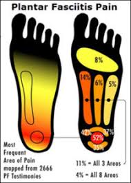 Foot Pain Identifier How To Identify And Diagnose Foot Pain