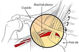 shoulder blade pain causes symptoms