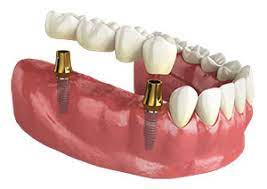 advanced dental concepts blog