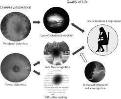 low vision on social function