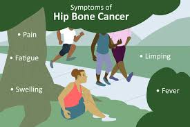 symptoms of bone cancer in the hip