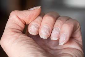 nail health when to schedule an