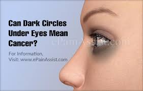 can dark circles under eyes mean cancer