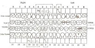 The Wounding Of Charlie Wilber Dental Chart Comparison