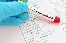 Liver Function Testing Mydr Com Au