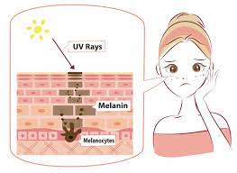 how to reduce melanin ion