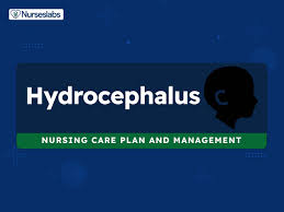 4 hydrocephalus nursing care plans