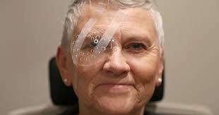 eye after cataract surgery