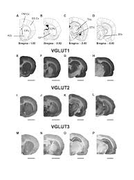 We would like to show you a description here but the site won't allow us. High Frequency Stimulation Of The Subthalamic Nucleus Modifies The Expression Of Vesicular Glutamate Transporters In Basal Ganglia In A Rat Model Of Parkinson S Disease Bmc Neuroscience Full Text