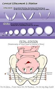 Cervical Dilation Effacement Station Chart