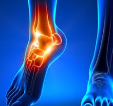 Resultado de imagen para dolor en los deportistas