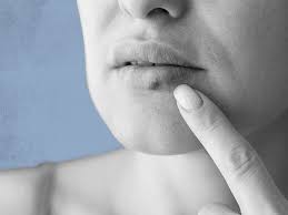 how to get rid of a cold sore quickly