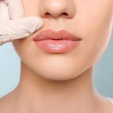best lip fillers injections in dubai