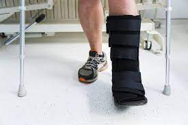 If the bones are significantly displaced (the bone alignment has been lost or there is an associated. Broken Foot Symptoms And Causes
