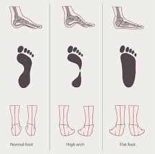 52 Right Foot Arch Chart