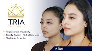 tria plastic surgery bangkok reviews
