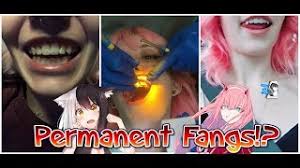 Lightning fast shipping on all in stock fangs. Getting Permanent Vampire Fangs Vlog Tooth Bonding Youtube