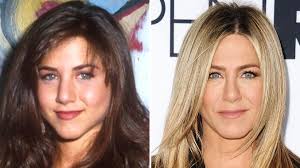 She became famous for her role as rachael green in the sitcom called friends. Jennifer Aniston How Her Face Has Changed From 1990 To 2016