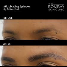 microblading eyebrows clinic in mumbai