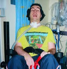 Locked-in Syndrome-Causes-Diagnosis-Trement-Options-Homeopathic-Allopathic-Dr-Qaisar-Ahmed-Risalpur-KPK-Pakistan