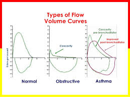 Spirometry Basics 2