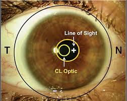Determining Multifocal Parameters For A Better Fit