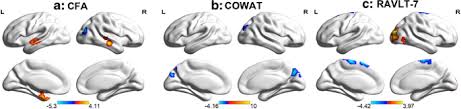 Наша группа вк наша конфа вк наш discord rocket league ru rl trade club. The Relationship Between Voxel Based Metrics Of Resting State Functional Connectivity And Cognitive Performance In Cognitively Healthy Elderly Adults Springerlink