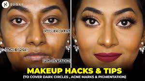 acne marks pigmentation