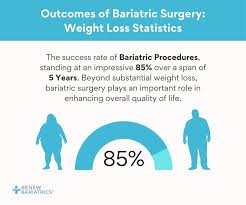 gastric sleeve surgery pros and cons
