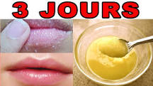 Résultat de recherche d'images pour "comment avoir les lèvres rose avec du citron ?"