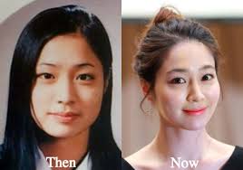 lee min jung plastic surgery before and
