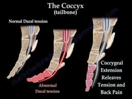 coccyx pain coccydynia tailbone pain